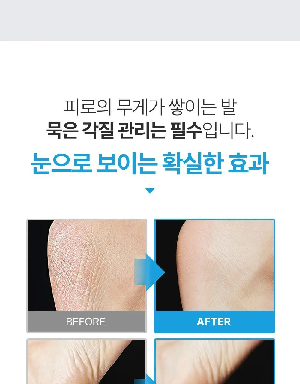 [2중 안전날]플루 퍼펙트 발 각질 면도기 상세페이지 5